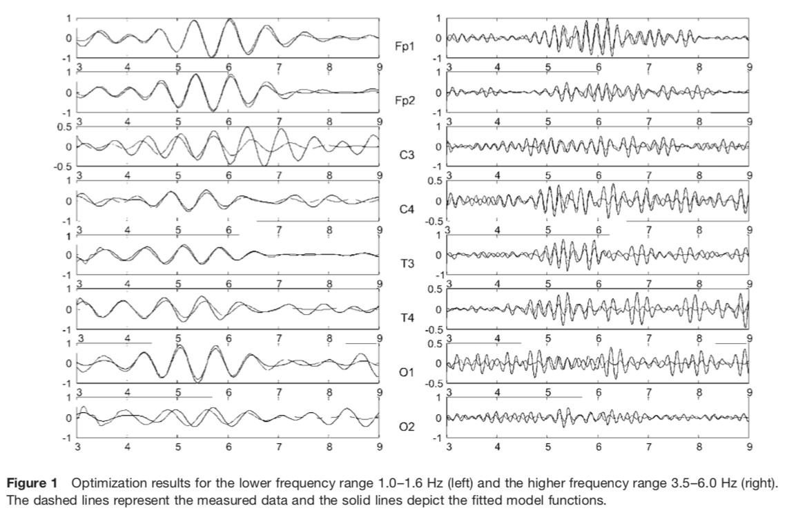 更新2019 7 11 脳波 Eeg を決定論的アプローチによって解析を試みている論文をいくつか紹介