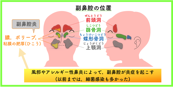 鼻のムヅムヅと匂い 蓄膿症 ちくのう症 かも チクナインを飲んでみた 症状など詳しく解説